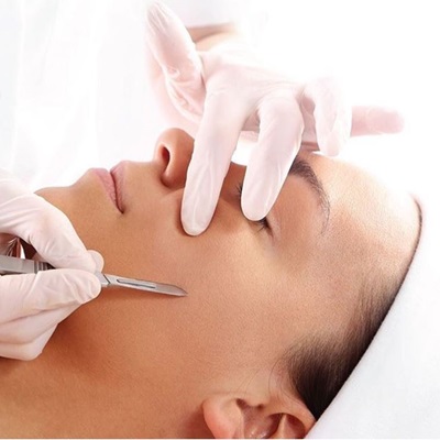 DERMAPLANING houston