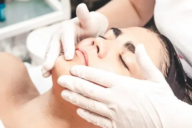 VI Peels Chemical peel houston