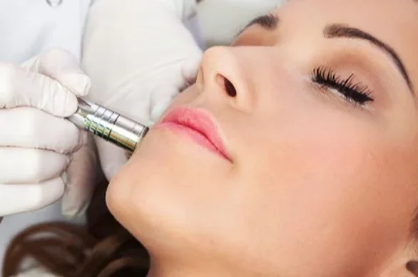 microdermabrasion houston spa